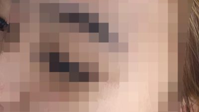 Dua Perempuan Jadi Korban Pengeroyokan di THM Daya, Harap Pelaku Segera Ditangkap